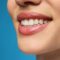 How Can Cosmetic Dentistry Improve Your Life, close up of woman's mouth showing teeth